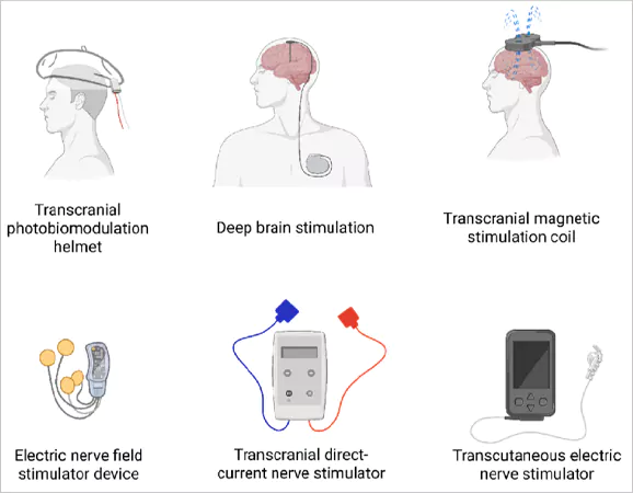 Example of Neurostimulation devices